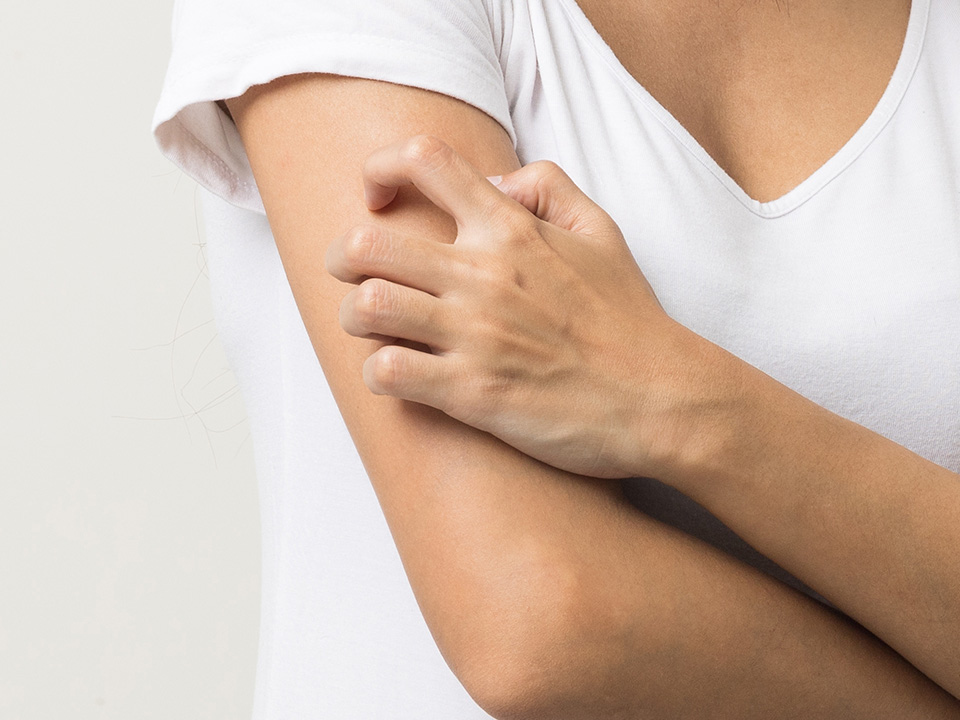 Irriterande nippor på armarna?