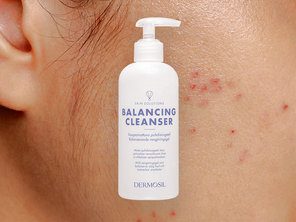 Rengöring av fet hy